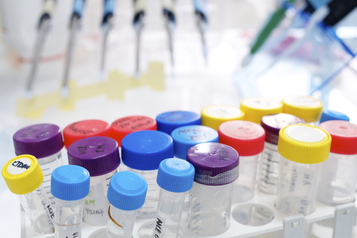The measures of biosensor performance and how to improve accuracy